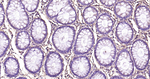 LUM Antibody in Immunohistochemistry (Paraffin) (IHC (P))