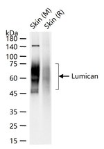 LUM Antibody in Western Blot (WB)