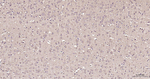 FASN Antibody in Immunohistochemistry (Paraffin) (IHC (P))