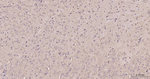 FASN Antibody in Immunohistochemistry (Paraffin) (IHC (P))