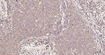 FASN Antibody in Immunohistochemistry (Paraffin) (IHC (P))
