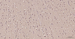 FASN Antibody in Immunohistochemistry (Paraffin) (IHC (P))