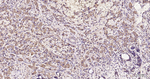 FASN Antibody in Immunohistochemistry (Paraffin) (IHC (P))