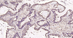 FASN Antibody in Immunohistochemistry (Paraffin) (IHC (P))