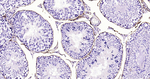 CD34 Antibody in Immunohistochemistry (Paraffin) (IHC (P))