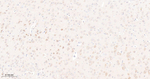 mTOR Antibody in Immunohistochemistry (Paraffin) (IHC (P))