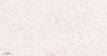 mTOR Antibody in Immunohistochemistry (Paraffin) (IHC (P))