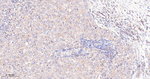 mTOR Antibody in Immunohistochemistry (Paraffin) (IHC (P))