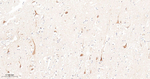 mTOR Antibody in Immunohistochemistry (Paraffin) (IHC (P))