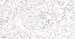mTOR Antibody in Immunohistochemistry (Paraffin) (IHC (P))