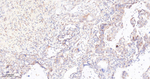 mTOR Recombinant Rabbit Monoclonal Antibody (3A10)
