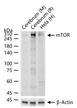 mTOR Antibody in Western Blot (WB)