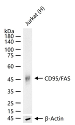 FAS Recombinant Rabbit Monoclonal Antibody (6F9)
