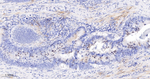 Survivin Antibody in Immunohistochemistry (Paraffin) (IHC (P))
