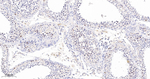 Survivin Antibody in Immunohistochemistry (Paraffin) (IHC (P))