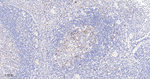Survivin Antibody in Immunohistochemistry (Paraffin) (IHC (P))