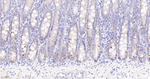Survivin Recombinant Rabbit Monoclonal Antibody (1D11)