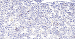 Survivin Antibody in Immunohistochemistry (Paraffin) (IHC (P))