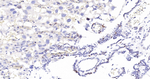 Survivin Antibody in Immunohistochemistry (Paraffin) (IHC (P))
