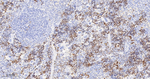Survivin Antibody in Immunohistochemistry (Paraffin) (IHC (P))