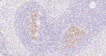 Survivin Antibody in Immunohistochemistry (Paraffin) (IHC (P))