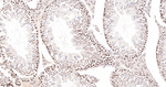 Survivin Antibody in Immunohistochemistry (Paraffin) (IHC (P))