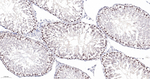 Survivin Antibody in Immunohistochemistry (Paraffin) (IHC (P))