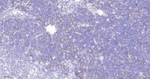 Survivin Antibody in Immunohistochemistry (Paraffin) (IHC (P))