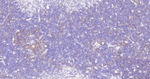 Survivin Antibody in Immunohistochemistry (Paraffin) (IHC (P))