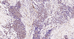 Phospho-ERK1/ERK2 (Thr202, Thr185) Antibody in Immunohistochemistry (Paraffin) (IHC (P))
