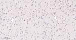 Phospho-STAT5 alpha (Tyr694) Antibody in Immunohistochemistry (Paraffin) (IHC (P))