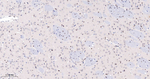 Phospho-STAT5 alpha (Tyr694) Antibody in Immunohistochemistry (Paraffin) (IHC (P))