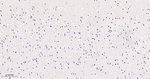 Phospho-STAT5 alpha (Tyr694) Antibody in Immunohistochemistry (Paraffin) (IHC (P))
