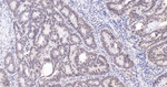 Phospho-SIRT1 (Ser47) Antibody in Immunohistochemistry (Paraffin) (IHC (P))
