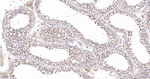 Phospho-SIRT1 (Ser47) Antibody in Immunohistochemistry (Paraffin) (IHC (P))