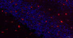 SOX1 Antibody in Immunohistochemistry (Paraffin) (IHC (P))