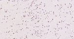SOX1 Antibody in Immunohistochemistry (Paraffin) (IHC (P))