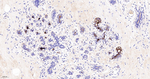 GCDFP-15 Antibody in Immunohistochemistry (Paraffin) (IHC (P))