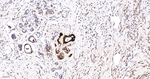GCDFP-15 Recombinant Rabbit Monoclonal Antibody (4B12)