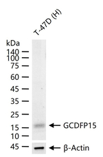 GCDFP-15 Antibody in Western Blot (WB)