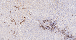 CD16 Antibody in Immunohistochemistry (Paraffin) (IHC (P))