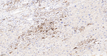 CD16 Antibody in Immunohistochemistry (Paraffin) (IHC (P))
