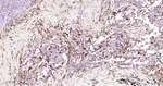 CD16 Antibody in Immunohistochemistry (Paraffin) (IHC (P))