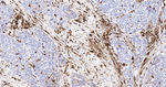CD16 Antibody in Immunohistochemistry (Paraffin) (IHC (P))