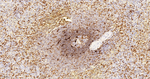 CD16 Antibody in Immunohistochemistry (Paraffin) (IHC (P))