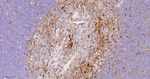 CD16 Antibody in Immunohistochemistry (Paraffin) (IHC (P))