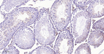 ADFP Antibody in Immunohistochemistry (Paraffin) (IHC (P))