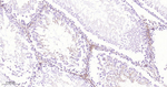 ADFP Antibody in Immunohistochemistry (Paraffin) (IHC (P))
