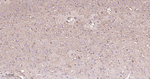 ADFP Antibody in Immunohistochemistry (Paraffin) (IHC (P))