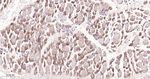 ADFP Antibody in Immunohistochemistry (Paraffin) (IHC (P))